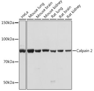 Calpain 2 Rabbit mAb