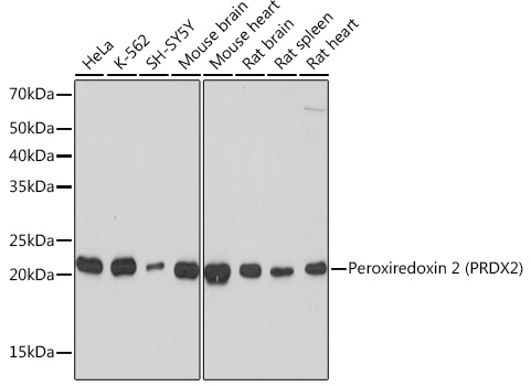 Peroxiredoxin 2 (PRDX2) Rabbit mAb