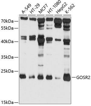 GOSR2 Rabbit pAb
