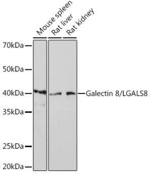Galectin 8/LGALS8 Rabbit mAb