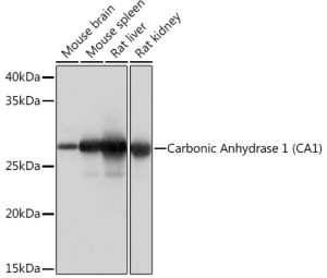 Carbonic Anhydrase 1 (CA1) Rabbit mAb