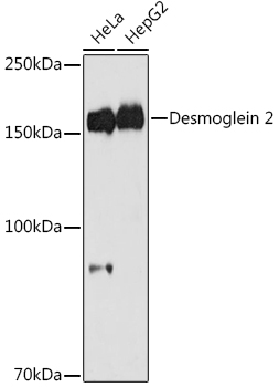 Desmoglein 2 Rabbit mAb