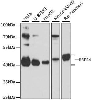 ERP44 Rabbit pAb