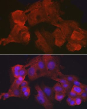 Villin1 Rabbit mAb