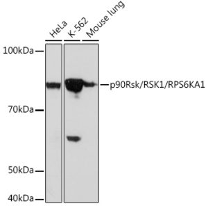 p90Rsk/RSK1/RPS6KA1 Rabbit mAb