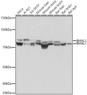 BMAL1 Rabbit mAb