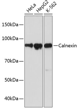 Calnexin Rabbit mAb