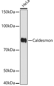 Caldesmon Rabbit mAb