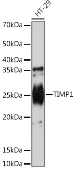 TIMP1 Rabbit mAb
