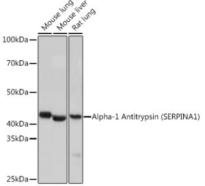 Alpha-1 Antitrypsin (SERPINA1) Rabbit mAb