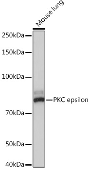 PKC epsilon Rabbit mAb