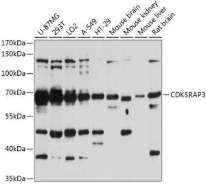 CDK5RAP3 Rabbit pAb