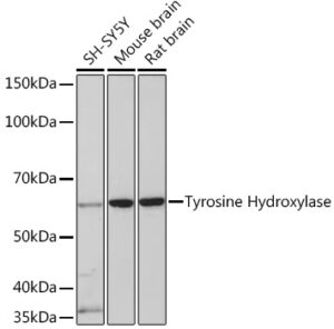 Tyrosine Hydroxylase Rabbit mAb