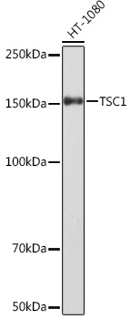 TSC1 Rabbit mAb