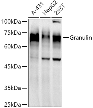 Granulin Rabbit mAb