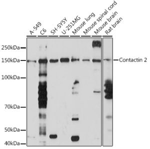 Contactin 2 Rabbit mAb