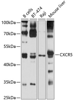 CXCR5 Rabbit pAb