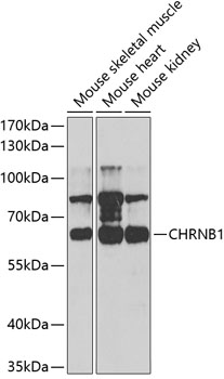CHRNB1 Rabbit pAb