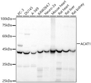 ACAT1 Rabbit pAb