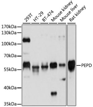 PEPD Rabbit pAb