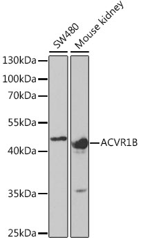 ACVR1B Rabbit pAb