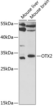 OTX2 Rabbit pAb