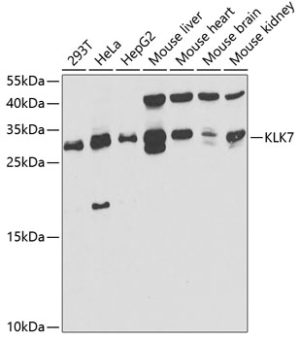 KLK7 Rabbit pAb