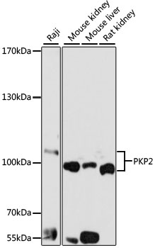 PKP2 Rabbit pAb