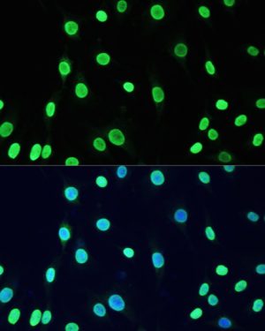 Acetyl-DNMT1-K1127/K1129/K1131/K1133 Rabbit pAb