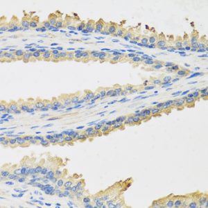 Leptin Rabbit pAb