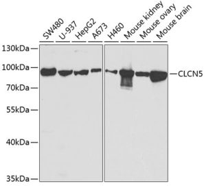 CLCN5 Rabbit pAb