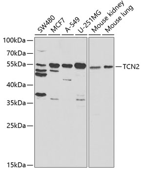 TCN2 Rabbit pAb