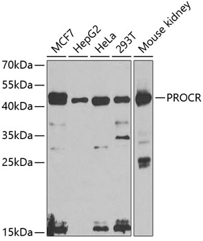 PROCR Rabbit pAb