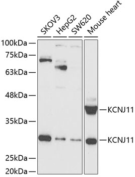 KCNJ11 Rabbit pAb