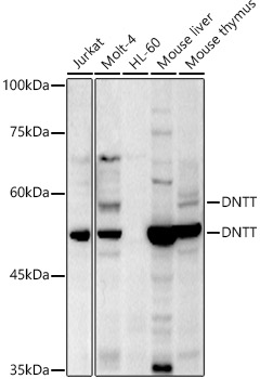 TdT Rabbit pAb