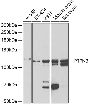 PTPN3 Rabbit pAb