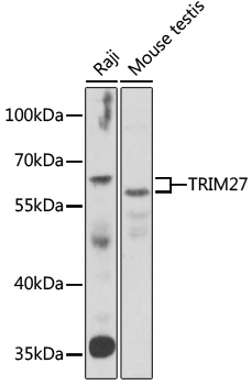 TRIM27 Rabbit pAb