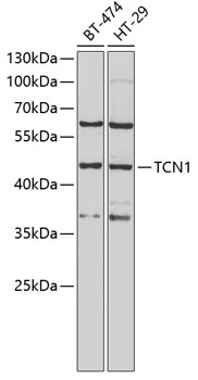 TCN1 Rabbit pAb