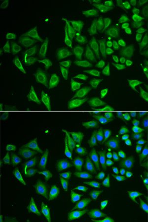 CLEC3B/Tetranectin Rabbit pAb