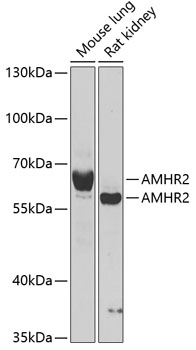 AMHR2 Rabbit pAb