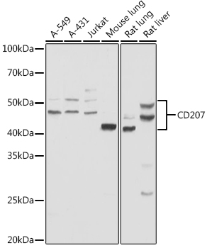 Langerin/CD207 Rabbit pAb