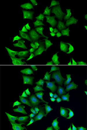 ENTPD2 Rabbit pAb