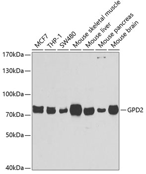 GPD2 Rabbit pAb