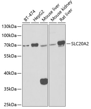 SLC20A2 Rabbit pAb