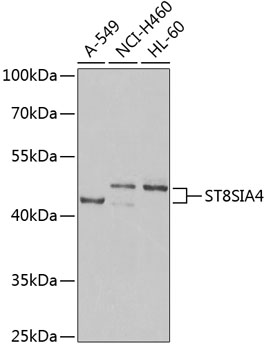 ST8SIA4 Rabbit pAb