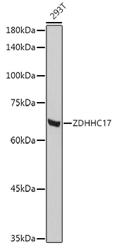 ZDHHC17 Rabbit pAb