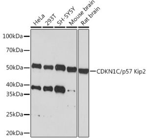 CDKN1C/p57 Kip2 Rabbit mAb