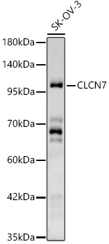 CLCN7 Rabbit pAb