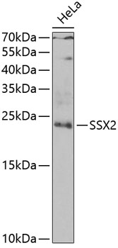 SSX2 Rabbit pAb