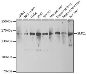 SMC1 Rabbit pAb